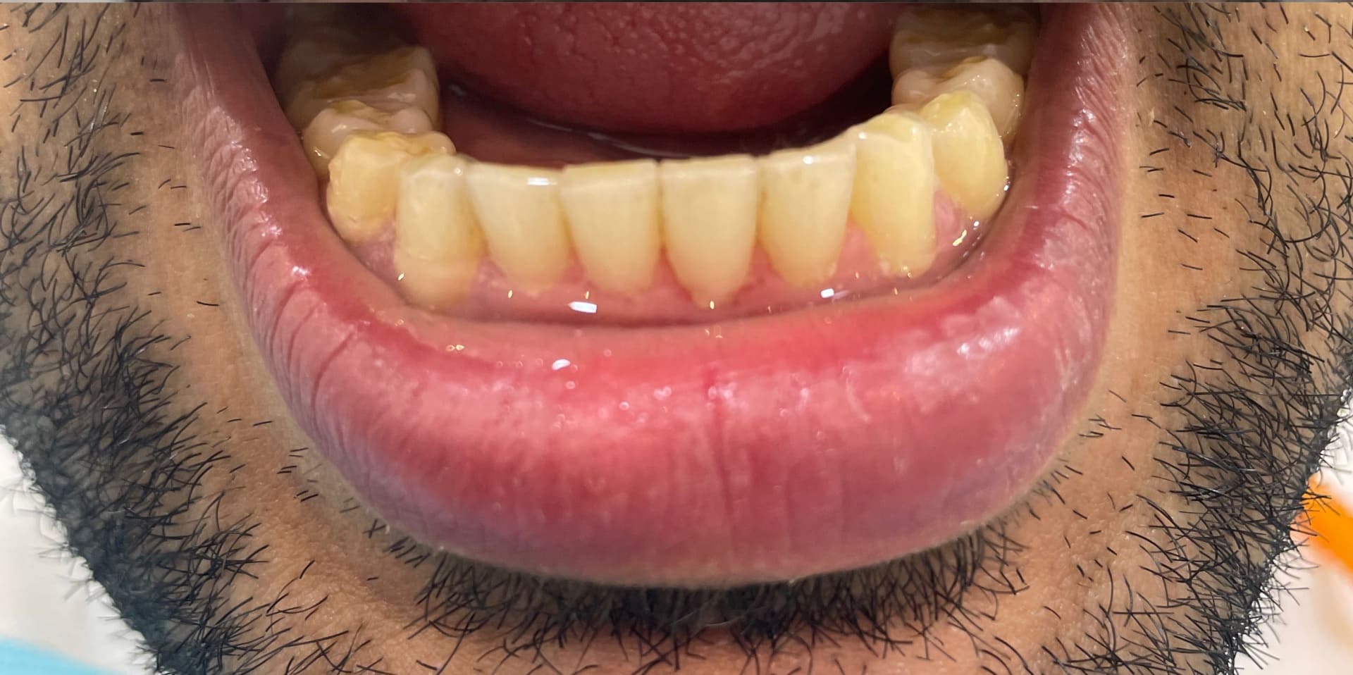 دكتور-اسنان-في-جدة-1