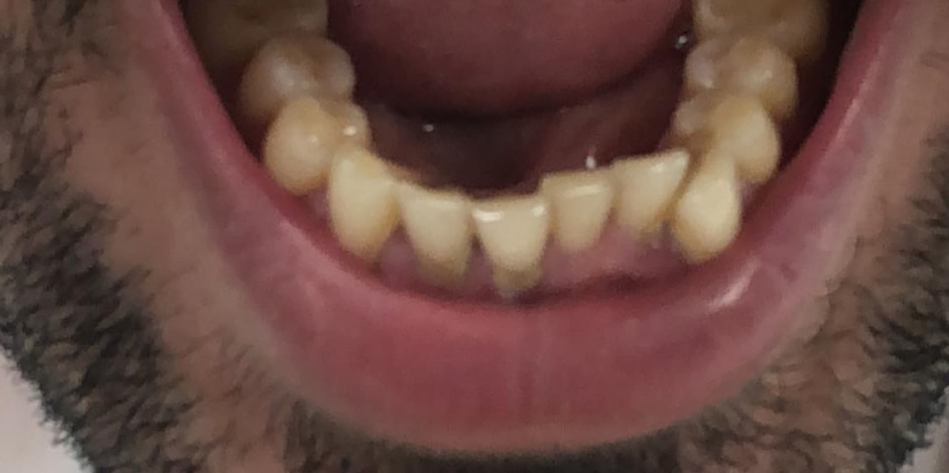 دكتور-اسنان-في-جدة