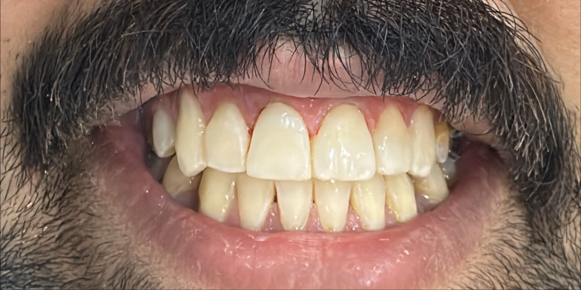 دكتور-تجميل-اسنان-في-جدة-1