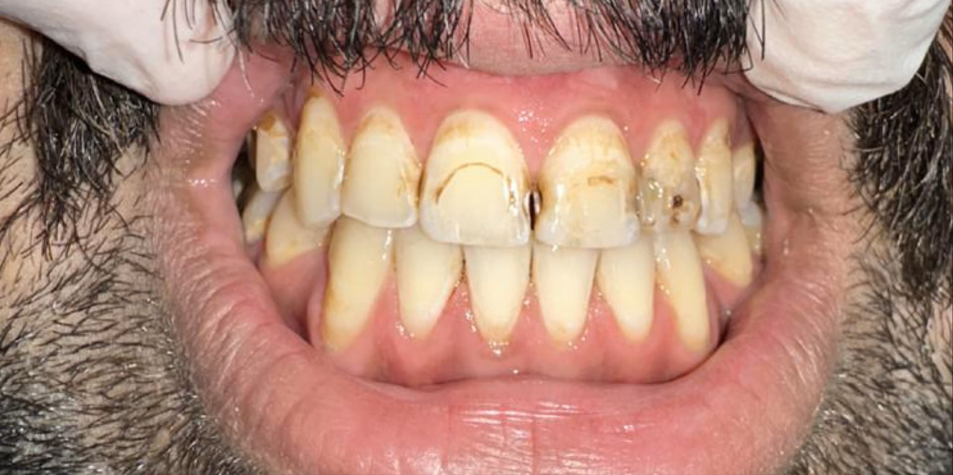 دكتور-تجميل-اسنان-في-جدة