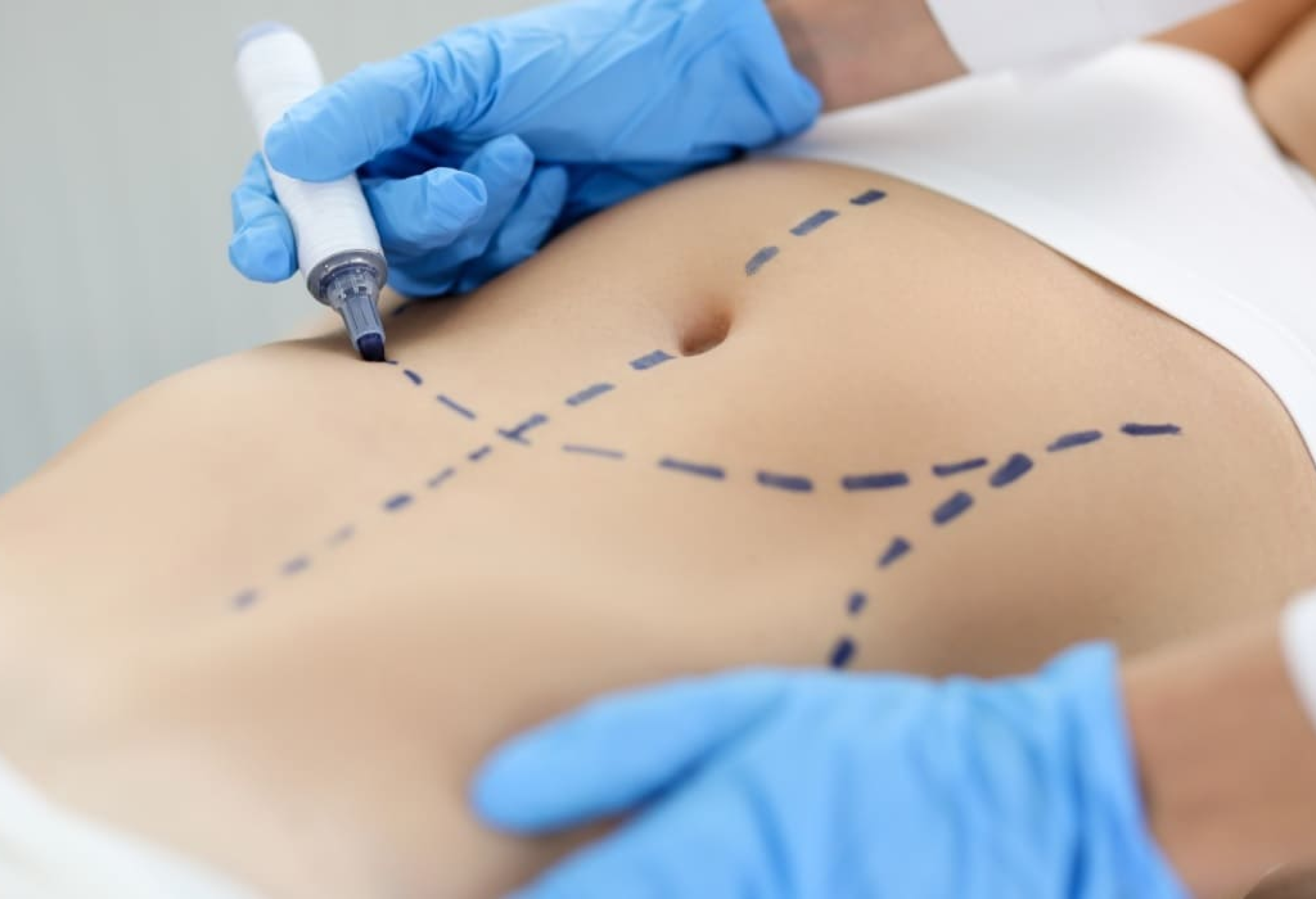 جراحة التجميل-biolifeclinic